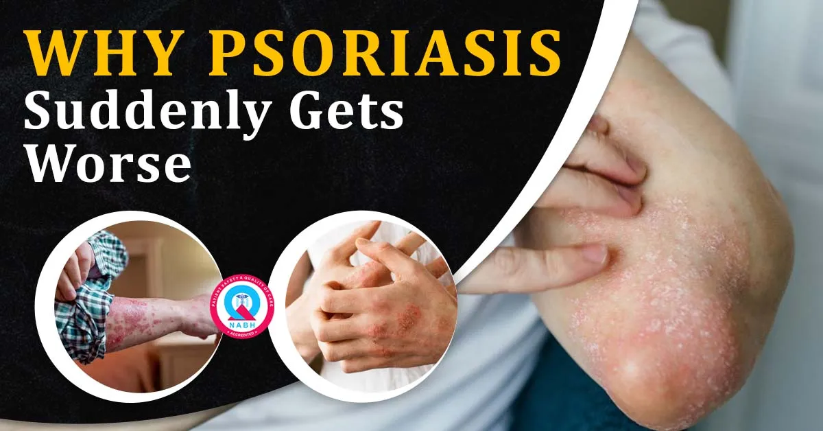 why-psoriasis-suddenly-gets-worse